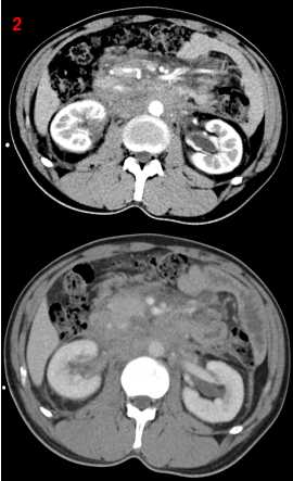 1702090369174765.png 2.png