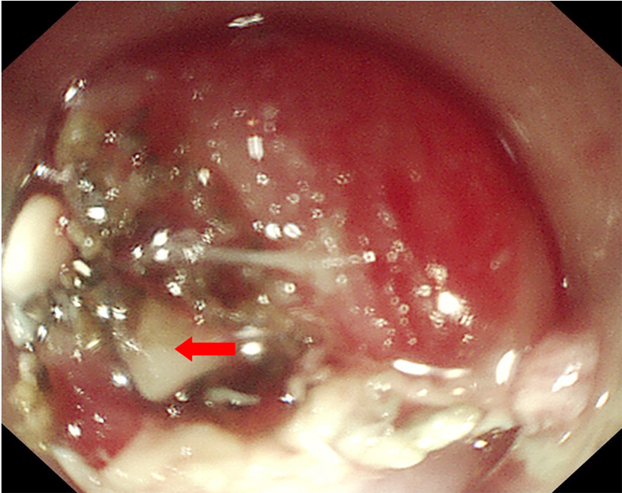 1704355589170678.png ff6f114271044a4c782f7ca9bdb14ac.png